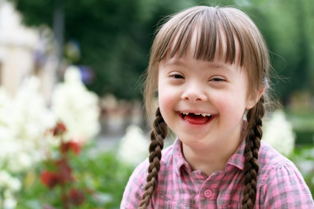 Smiling child with missing teeth.